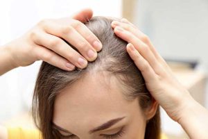 مزوتراپی مو برای درمان ریزش مو