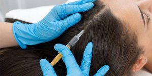 تاثیر مزوتراپی مو چیست؟