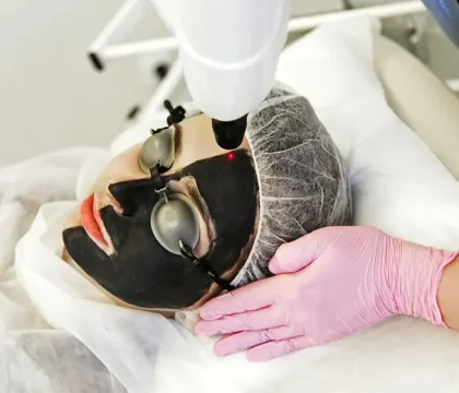 Carbon-therapy-2
