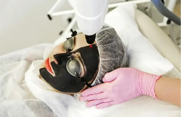 Carbon-therapy-2