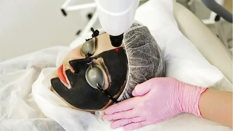 Carbon-therapy-2