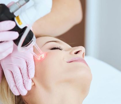 Laser-facial-hair-removal