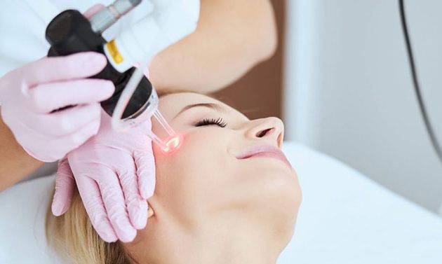 Laser-facial-hair-removal