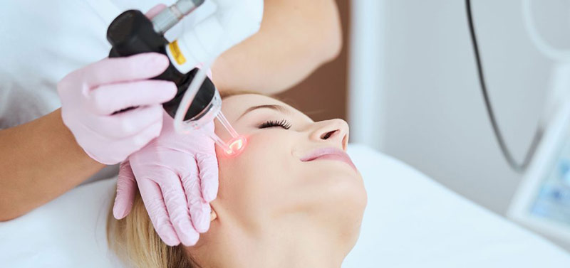 Laser-facial-hair-removal