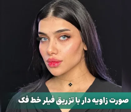 صورت-زاویه-دار-با-تزریق-فیلر-خط-فک