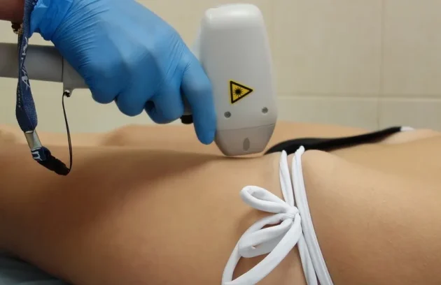 Vaginal-laser-hair-removal