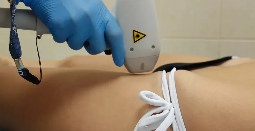 Vaginal-laser-hair-removal