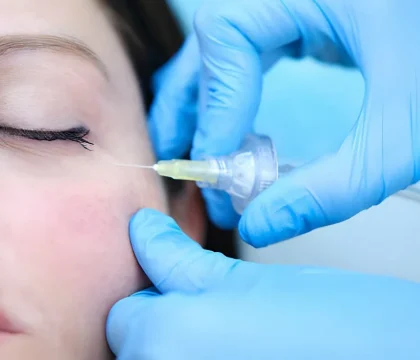 carboxytherapy-4