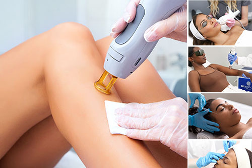 laser_hair_removal3
