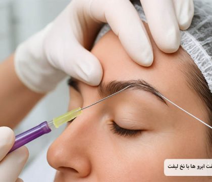معرفی بهترین مارک های نخ لیفت